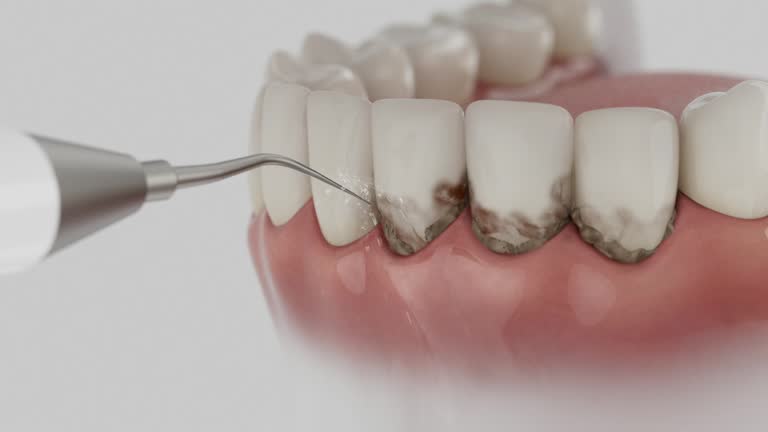 Trusted Tooth Extraction service in Pleasant Hill, MS - Dentist Open Now